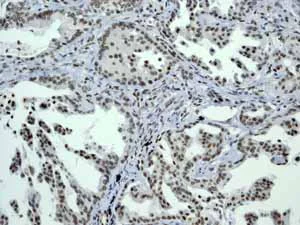Immunohistochemistry (Formalin/PFA-fixed paraffin-embedded sections) - Anti-CENPA antibody [EP800Y] - Centromere Marker (AB45694)