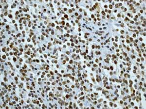 Immunohistochemistry (Formalin/PFA-fixed paraffin-embedded sections) - Anti-CENPA antibody [EP800Y] - Centromere Marker (AB45694)
