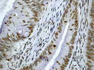 Immunohistochemistry (Formalin/PFA-fixed paraffin-embedded sections) - Anti-CENPA antibody [EP800Y] - Centromere Marker (AB45694)
