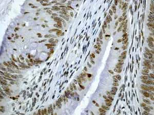 Immunohistochemistry (Formalin/PFA-fixed paraffin-embedded sections) - Anti-CENPA antibody [EP800Y] - Centromere Marker (AB45694)