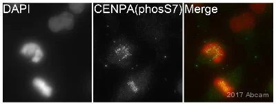 Immunocytochemistry/ Immunofluorescence - Anti-CENPA (phospho S7) antibody (AB62242)