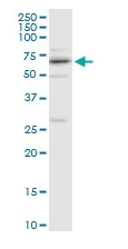 Western blot - Anti-CENPB antibody (AB167361)