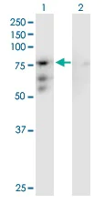 Western blot - Anti-CENPB antibody (AB167361)