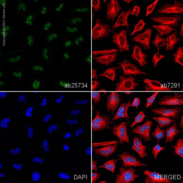 Immunocytochemistry/ Immunofluorescence - Anti-CENPB antibody (AB25734)