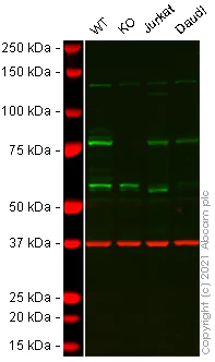 Western blot - Anti-CENPB antibody (AB25734)