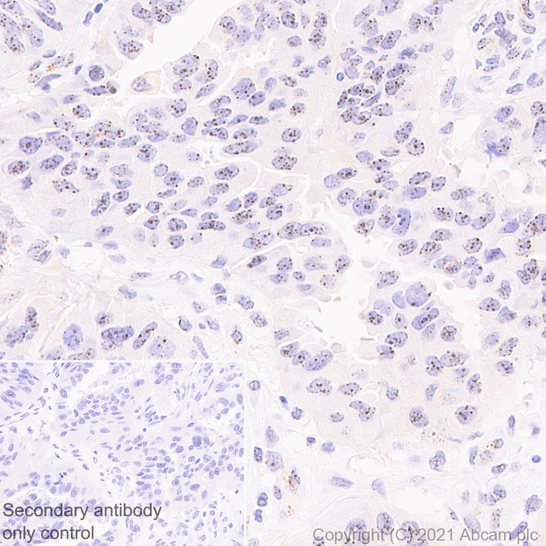 Immunohistochemistry (Formalin/PFA-fixed paraffin-embedded sections) - Anti-CENPB antibody [EPR24047-64] (AB259855)