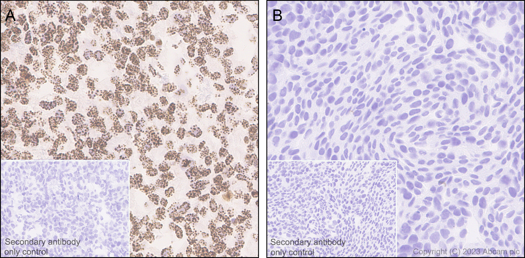 Immunohistochemistry (Formalin/PFA-fixed paraffin-embedded sections) - Anti-CENPB antibody [EPR24047-64] (AB259855)