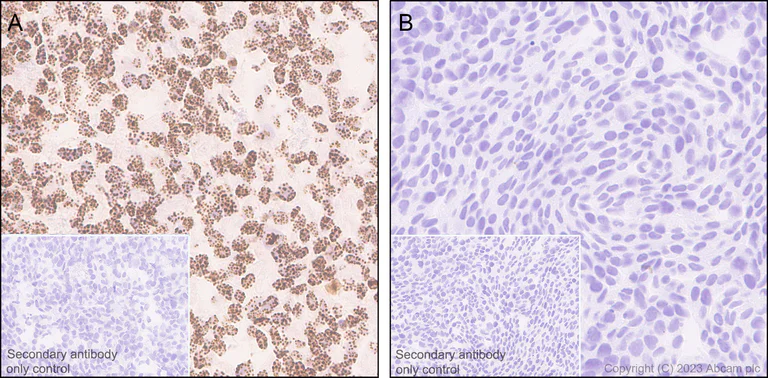 Immunohistochemistry (Formalin/PFA-fixed paraffin-embedded sections) - Anti-CENPB antibody [EPR24047-64] (AB259855)