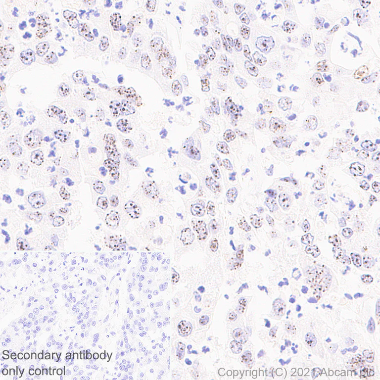 Immunohistochemistry (Formalin/PFA-fixed paraffin-embedded sections) - Anti-CENPB antibody [EPR24047-64] - BSA and Azide free (AB284394)