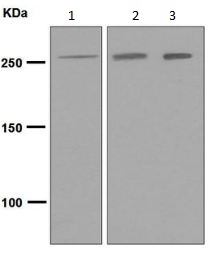 Western blot - Anti-CENPE antibody [EPR4542(2)] (AB133583)