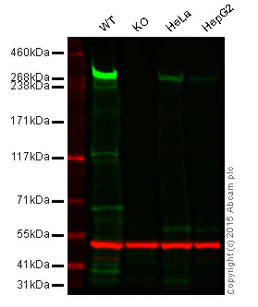 Anti-CENPE antibody [EPR4543(2)]