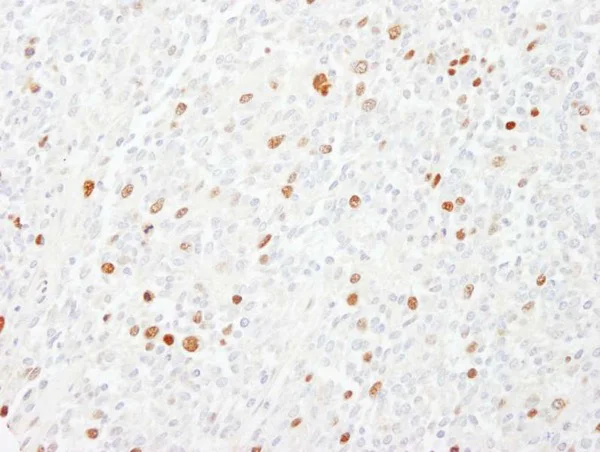 Immunohistochemistry (Formalin/PFA-fixed paraffin-embedded sections) - Anti-CENPF antibody (AB224813)