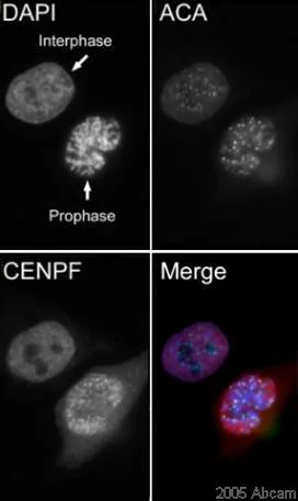 Immunocytochemistry/ Immunofluorescence - Anti-CENPF antibody (AB5)
