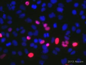 Immunocytochemistry/ Immunofluorescence - Anti-CENPF antibody (AB5)