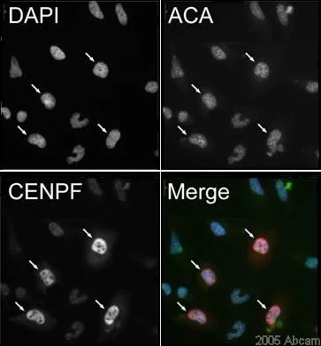 Immunocytochemistry/ Immunofluorescence - Anti-CENPF antibody (AB5)