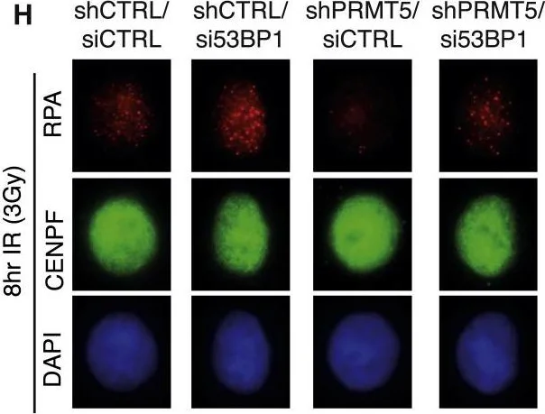 Immunocytochemistry/ Immunofluorescence - Anti-CENPF antibody (AB5)