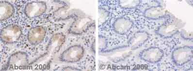 Immunohistochemistry (Formalin/PFA-fixed paraffin-embedded sections) - Anti-CENPF antibody (AB5)