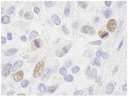Immunohistochemistry (Formalin/PFA-fixed paraffin-embedded sections) - Anti-CENPF antibody (AB84697)