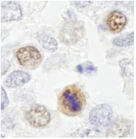 Immunohistochemistry (Formalin/PFA-fixed paraffin-embedded sections) - Anti-CENPF antibody (AB84697)