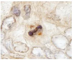 Immunohistochemistry (Formalin/PFA-fixed paraffin-embedded sections) - Anti-CENPF antibody (AB84697)