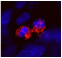 Immunohistochemistry (Formalin/PFA-fixed paraffin-embedded sections) - Anti-CENPF antibody (AB84697)