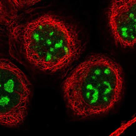 Immunocytochemistry/ Immunofluorescence - Anti-CENPH antibody (AB224159)