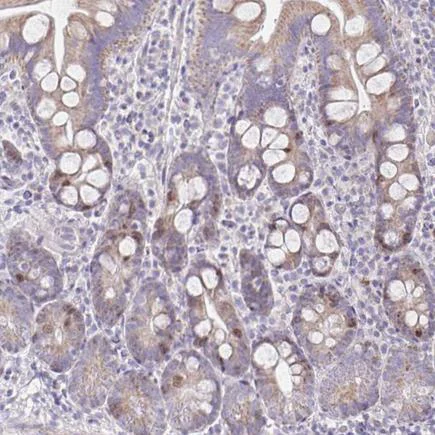 Immunohistochemistry (Formalin/PFA-fixed paraffin-embedded sections) - Anti-CENPH antibody (AB224159)