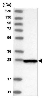 Western blot - Anti-CENPH antibody (AB224159)