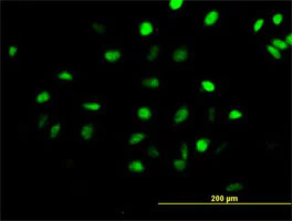 Immunocytochemistry/ Immunofluorescence - Anti-CENPH antibody (AB88593)