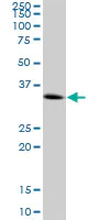 Western blot - Anti-CENPH antibody (AB88593)