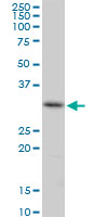Western blot - Anti-CENPH antibody (AB88593), expandable thumbnail