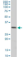 Western blot - Anti-CENPH antibody (AB88593)
