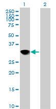 Western blot - Anti-CENPH antibody (AB88593), expandable thumbnail