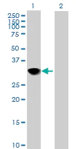 Western blot - Anti-CENPH antibody (AB88593)