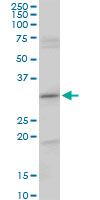 Western blot - Anti-CENPH antibody (AB88593), expandable thumbnail