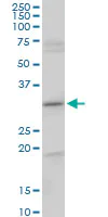 Western blot - Anti-CENPH antibody (AB88593)