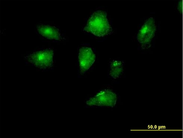 Immunocytochemistry/ Immunofluorescence - Anti-CENPI antibody (AB168778)