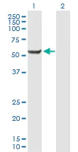 Western blot - Anti-CENPI antibody (AB168778)