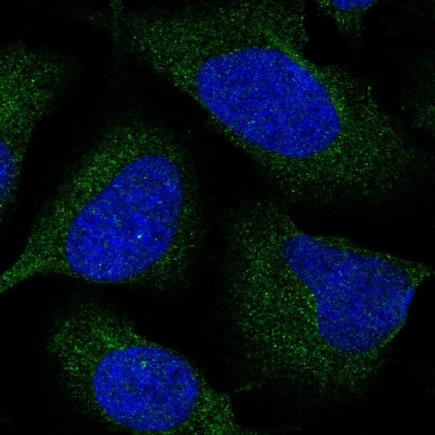 Immunocytochemistry/ Immunofluorescence - Anti-CENPM antibody (AB243820)