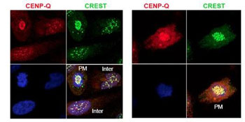 Immunocytochemistry/ Immunofluorescence - Anti-CENPQ antibody (AB105742)