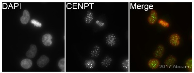 Immunocytochemistry/ Immunofluorescence - Anti-CENPT antibody (AB220280)