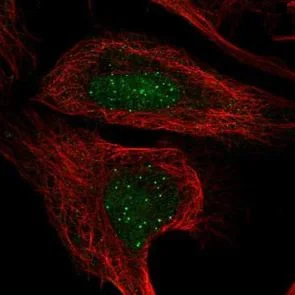 Immunocytochemistry/ Immunofluorescence - Anti-CENPT antibody (AB220280)