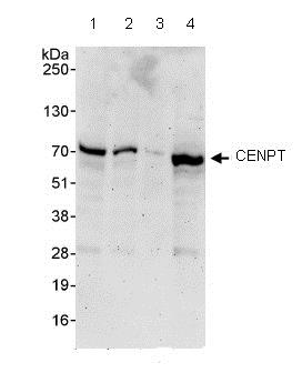 Western blot - Anti-CENPT antibody (AB86595)