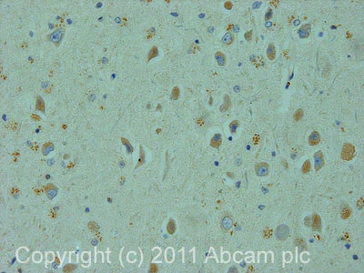 Immunohistochemistry (Formalin/PFA-fixed paraffin-embedded sections) - Anti-Centaurin alpha 1 antibody (AB27476)