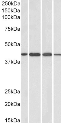 Western blot - Anti-Centaurin alpha 1 antibody (AB27476), expandable thumbnail