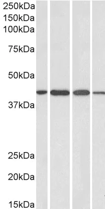 Western blot - Anti-Centaurin alpha 1 antibody (AB27476)