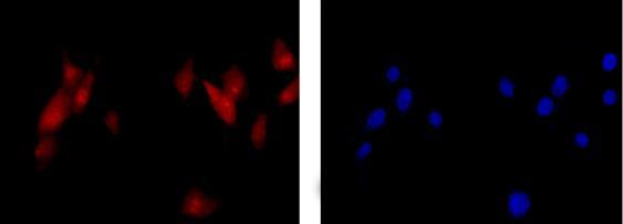 Immunocytochemistry/ Immunofluorescence - Anti-Centaurin alpha 1 antibody [EPR14285] - BSA and Azide free (AB250650), expandable thumbnail