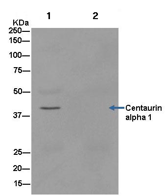Immunoprecipitation - Anti-Centaurin alpha 1 antibody [EPR14285] - BSA and Azide free (AB250650), expandable thumbnail