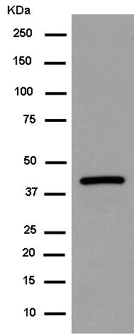Western blot - Anti-Centaurin alpha 1 antibody [EPR14285] - BSA and Azide free (AB250650), expandable thumbnail