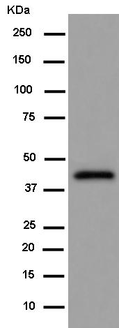 Western blot - Anti-Centaurin alpha 1 antibody [EPR14285] - BSA and Azide free (AB250650), expandable thumbnail